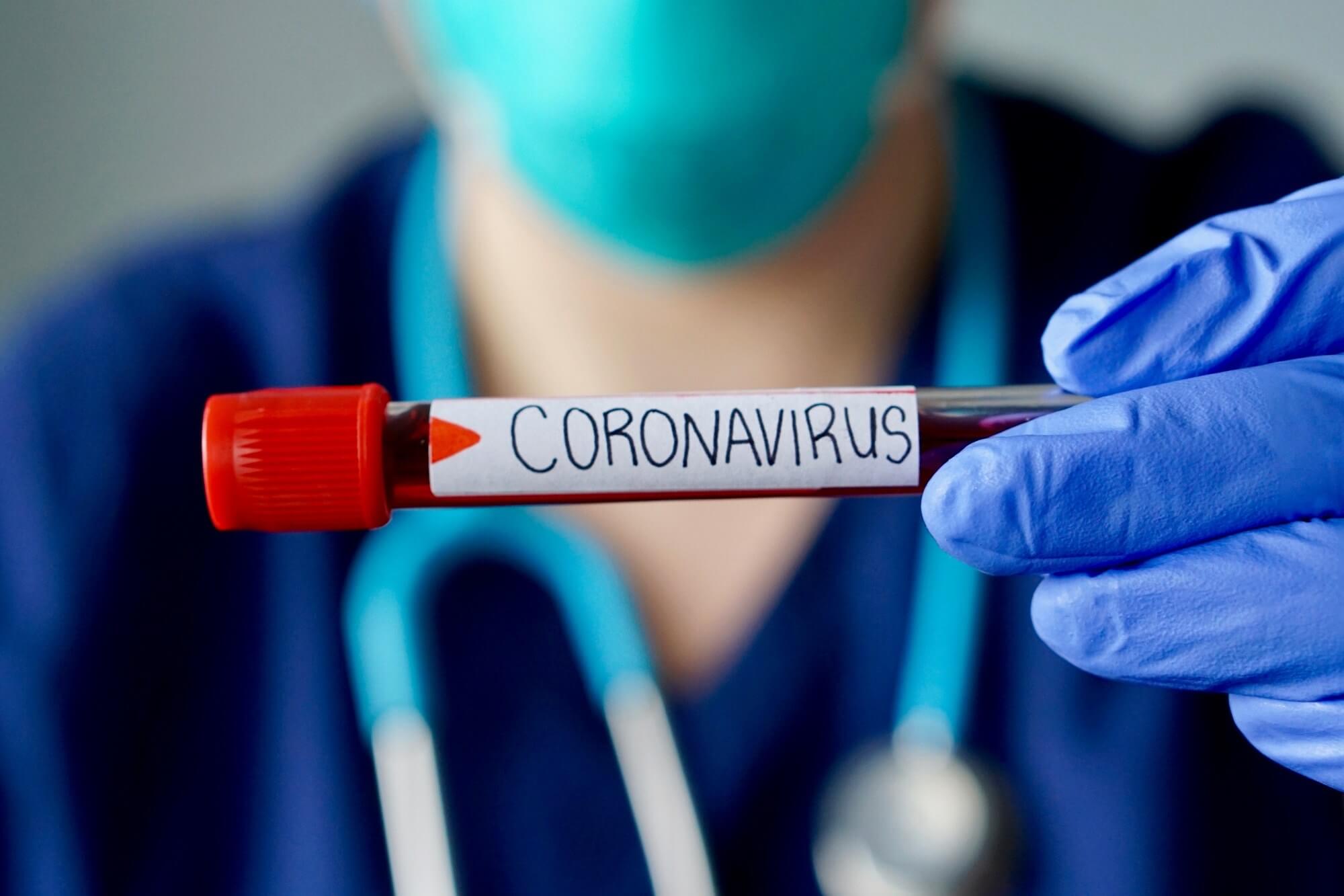Grupo de hackers quebra promessa de não atingir organizações médicas durante surto de coronavírus
