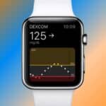 apple-watch-combinado-com-monitor-de-glicose-salva-vida-de-cinegrafista-diabetico